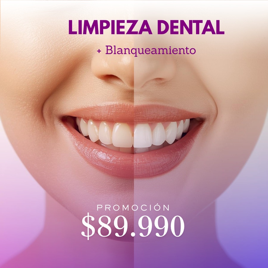 Promoción limpieza dental más blanqueamiento